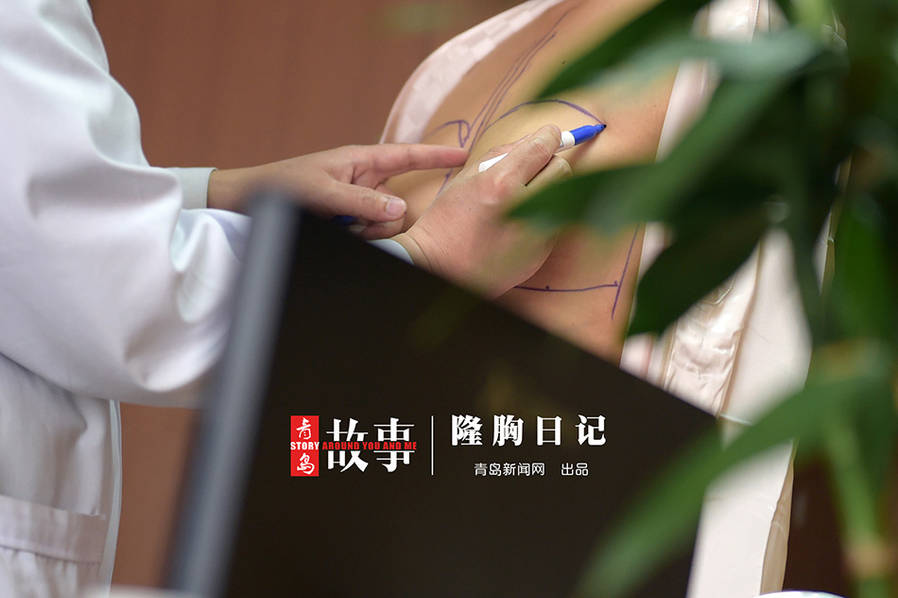 90后模特隆胸全过程图组张家口新闻网 